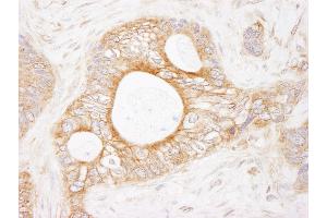 Immunohistochemistry (IHC) image for anti-Eukaryotic Elongation Factor-2 Kinase (EEF2K) (AA 1-50) antibody (ABIN7454772)