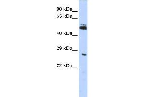 WB Suggested Anti-RNF212 Antibody Titration:  0. (RNF212 anticorps  (Middle Region))