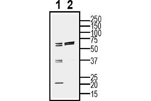 Western blot analysis of mouse  cell line lysate (lane 1) and BV2-derived purified exosomes (lane 2)50 μg of cells and purified exosomes lysates were analyzed using Anti-CD81 (extracellular) Antibody (ABIN7581847), (1:200). (CD81 anticorps  (Extracellular))