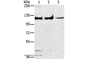Western blot analysis of Human fetal muscle tissue, A172 and K562 cell, using MAPK7 Polyclonal Antibody at dilution of 1:250 (MAPK7 anticorps)