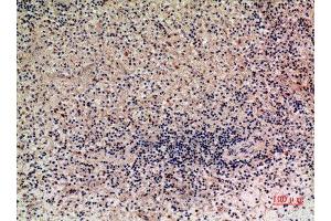Immunohistochemistry (IHC) analysis of paraffin-embedded Human Liver, antibody was diluted at 1:100.
