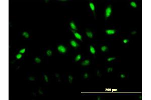 Immunofluorescence of monoclonal antibody to MAPK6 on HeLa cell.