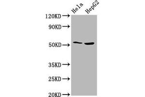 Western Blot Positive WB detected in: Hela whole cell lysate, HepG2 whole cell lysate All lanes: THNSL2 antibody at 4. (THNSL2 anticorps  (AA 295-441))
