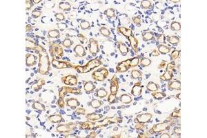 Immunohistochemistry analysis of paraffin-embedded rat kidney using,NHE-3 (ABIN7075685) at dilution of 1: 1200 (SLC9A3 anticorps)