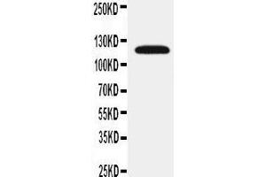 Anti-SLC12A1 antibody, Western blotting WB: Rat Kidney Tissue Lysate (SLC12A1 anticorps  (N-Term))