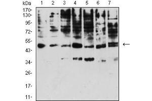 Western blot analysis using KIR3DL1 mouse mAb against A431 (1), Raji (2), SPC-A-1 (3), K562 (4), HEK293 (5), U937 (6), and C6 (7) cell lysate.