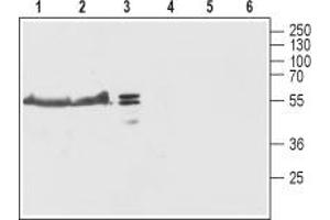 Western blot analysis of rat brain (lanes 1 and 4), mouse brain (lanes 2 and 5) and SH-SY5Y (lanes 3 and 6) lysates: - 1-3. (TMEM38B anticorps  (Cytoplasmic Loop, Intracellular))