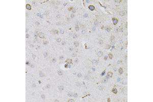 Immunohistochemistry of paraffin-embedded mouse brain using CEACAM5 antibody. (CEACAM5 anticorps)