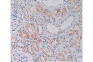 Detection of VNN1 in Human Kidney Tissue using Polyclonal Antibody to Vanin 1 (VNN1)
