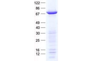 Validation with Western Blot