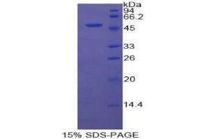 SDS-PAGE analysis of Cow Coagulation Factor V Protein. (Coagulation Factor V Protein (F5))