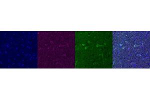 Immunohistochemistry (IHC) image for anti-Glutamate Receptor 1 (GLUR1) antibody (ABIN7455993)