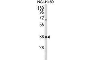 Western blot analysis of TAZ Antibody (N-term) in NCI-H460 cell line lysates (35ug/lane). (TAZ anticorps  (N-Term))