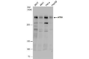 WB Image ATRX antibody detects ATRX protein by western blot analysis. (ATRX anticorps  (C-Term))