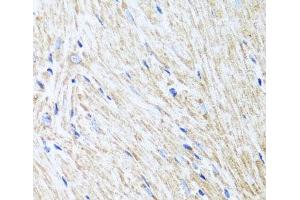 Immunohistochemistry of paraffin-embedded Mouse heart using L2HGDH Polyclonal Antibody at dilution of 1:100 (40x lens). (L2HGDH anticorps)