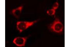 ABIN6274246 staining 293 cells by IF/ICC. (Activin A Receptor Type IB/ALK-4 anticorps  (Internal Region))