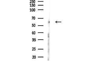 Western blot analysis of lysates from Hela cells(starvation,24h treatment), using C Antibody at 1/1000 dilution.