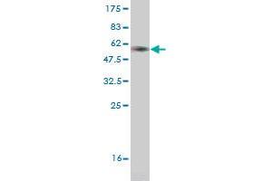 Western Blot detection against Immunogen (36. (CRYGD anticorps  (AA 75-174))