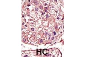 Immunohistochemistry (IHC) image for anti-Transforming Growth Factor, beta Receptor 1 (TGFBR1) antibody (ABIN3003515) (TGFBR1 anticorps)