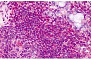 Human Lymphocytes: Formalin-Fixed, Paraffin-Embedded (FFPE) (CCDC50 anticorps  (AA 468-481))