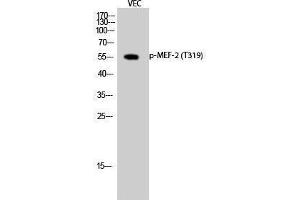 Western Blotting (WB) image for anti-Myelin Expression Factor 2 (MYEF2) (pThr319) antibody (ABIN3172926) (MYEF2 anticorps  (pThr319))