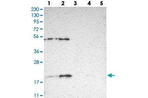 Western blot analysis of Lane 1: RT-4, Lane 2: U-251 MG, Lane 3: Human Plasma, Lane 4: Liver, Lane 5: Tonsil with APOO polyclonal antibody .