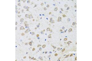 Immunohistochemistry of paraffin-embedded mouse brain using ARL6 antibody (ABIN5974886) at dilution of 1/100 (40x lens). (ARL6 anticorps)