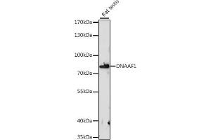 Western blot analysis of extracts of rat testis, using DN antibody (ABIN7268219) at 1:1000 dilution. (LRRC50 anticorps  (AA 516-725))