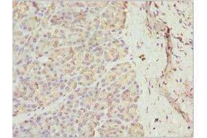 Immunohistochemistry of paraffin-embedded human pancreatic tissue using ABIN7167363 at dilution of 1:100 (Rab5c anticorps  (AA 1-216))