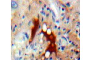 IHC-P analysis of Liver tissue, with DAB staining. (ASK1 anticorps  (AA 693-933))