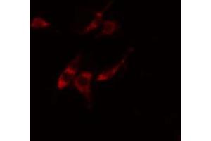 ABIN6274861 staining Hela cells by IF/ICC. (ARFIP1 anticorps  (Internal Region))