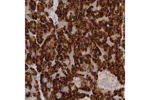 Immunohistochemical staining of human pancreas with NXT2 polyclonal antibody  shows strong cytoplasmic positivity in exocrine cells. (NXT2 anticorps)