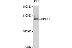 Western Blotting (WB) image for anti-Proline-, Glutamic Acid- and Leucine-Rich Protein 1 (PELP1) (AA 1021-1180) antibody (ABIN3023502) (PELP1 anticorps  (AA 1021-1180))