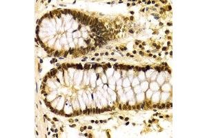 Immunohistochemistry of paraffin-embedded human colon using KPNA4 Antibody.