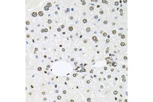 Immunohistochemistry of paraffin-embedded mouse liver using HDAC3 antibody. (HDAC3 anticorps)