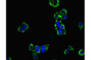 Immunofluorescent analysis of PC-3 cells using ABIN7155221 at dilution of 1:100 and Alexa Fluor 488-congugated AffiniPure Goat Anti-Rabbit IgG(H+L) (HPCAL1 anticorps  (AA 2-193))