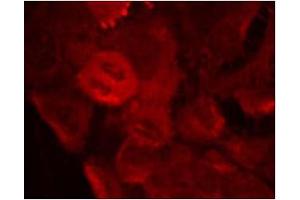 Image no. 1 for anti-Mitogen-Activated Protein Kinase Kinase 2 (MAP2K2) (pThr394) antibody (ABIN196623) (MEK2 anticorps  (pThr394))