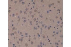 Used in DAB staining on fromalin fixed paraffin- embedded brain tissue (TOP1MT anticorps  (AA 11-238))