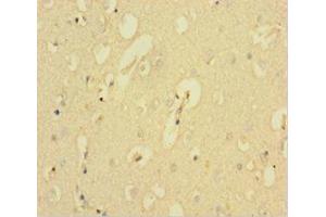 Immunohistochemistry of paraffin-embedded human brain tissue using ABIN7146334 at dilution of 1:100
