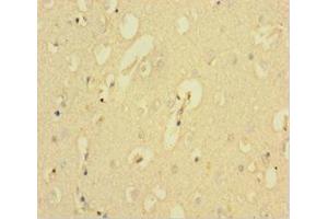 Immunohistochemistry of paraffin-embedded human brain tissue using ABIN7146334 at dilution of 1:100 (KCNMA1 anticorps  (AA 1-86))