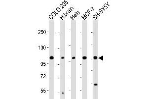 All lanes : Anti-KCNH1 Antibody (C-Term) at 1:2000 dilution Lane 1: COLO 205 whole cell lysate Lane 2: Human brain lysate Lane 3: Hela whole cell lysate Lane 4: MCF-7 whole cell lysate Lane 5: SH-SY5Y whole cell lysate Lysates/proteins at 20 μg per lane. (KCNH1 anticorps  (AA 787-820))