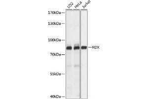 Western blot analysis of extracts of various cell lines using RDX Polyclonal Antibody at dilution of 1:1000. (Radixin anticorps)