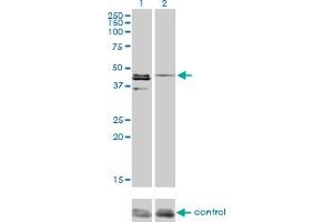Western blot analysis of CSNK1G1 over-expressed 293 cell line, cotransfected with CSNK1G1 Validated Chimera RNAi (Lane 2) or non-transfected control (Lane 1).