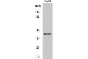Western Blotting (WB) image for anti-Actin, beta-Like 2 (ACTBL2) (Internal Region) antibody (ABIN3173670) (ACTBL2 anticorps  (Internal Region))