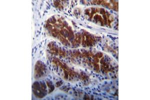 Immunohistochemistry (IHC) image for anti-Fyn-Related Kinase (FRK) antibody (ABIN3003444)