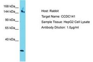 Image no. 1 for anti-Coiled-Coil Domain Containing 141 (CCDC141) (AA 639-688) antibody (ABIN6750788) (CCDC141 anticorps  (AA 639-688))