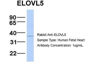Host:  Rabbit  Target Name:  ELOVL5  Sample Type:  Human Fetal Heart  Antibody Dilution:  1. (ELOVL5 anticorps  (N-Term))