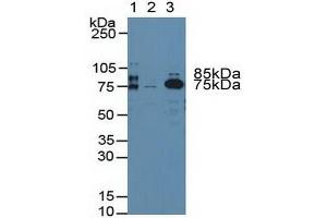 Western blot analysis of (1) Rat Blood Cells, (2) Human Platelet Cells and (3) Rat Serum. (Prothrombin anticorps  (AA 324-617))