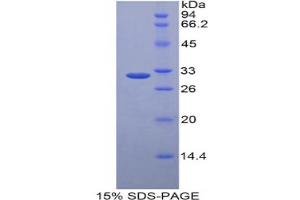 SDS-PAGE analysis of Human LRP5L Protein. (LRP5L Protéine)