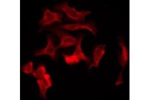 ABIN6276191 staining Hela by IF/ICC.